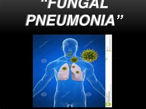 Fungal Pneumonia