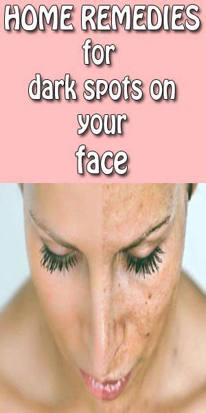 Best Home Remedies For Dark Spots On Face You Never Know Natural