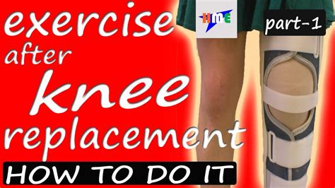 Exercises After Knee Replacement Part 1 How To Do It Knee