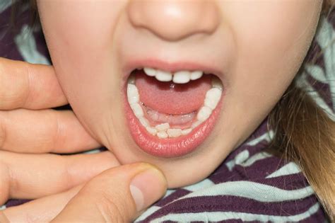 Curious Kids Why Do We Lose Our Baby Teeth