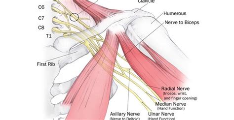Brachial Plexus Injury Lawyers Settle Difficult Case Before Trial For
