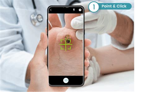Digital Wound Care Wound Imaging Measurement And Assessment