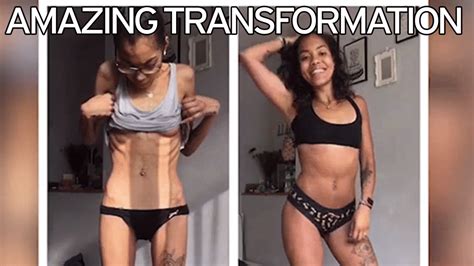 Shocking Pictures Of Anorexic Who Did 50 000 Sit Ups A Day And Ate Virtually Nothing Irish