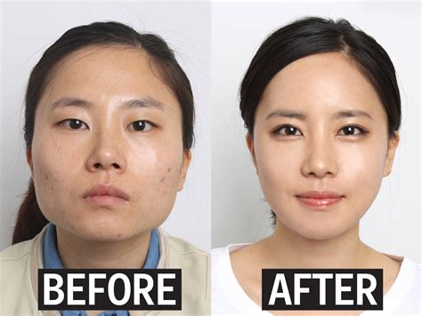 Why Korean Parents Are Paying For Their Kids To Get Plastic Surgery