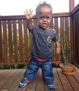dailysighted quaden bayles with dwarfism called ugly by cruel online trolls over facebook