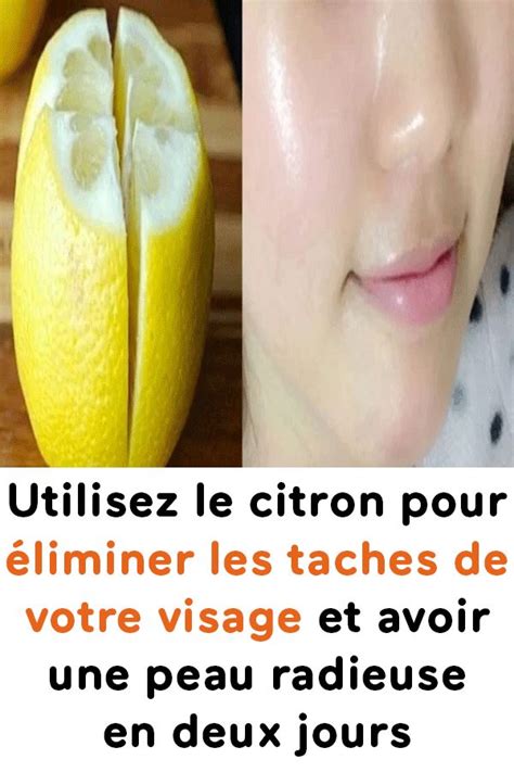 Utilisez Le Citron Pour éliminer Les Taches De Votre Visage Et Avoir