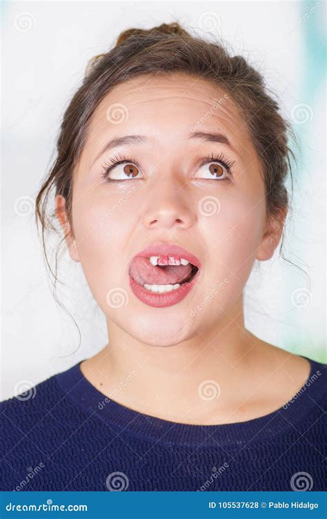 Close Up Of Surprise Beautiful Woman Touching Her Teeth With Their