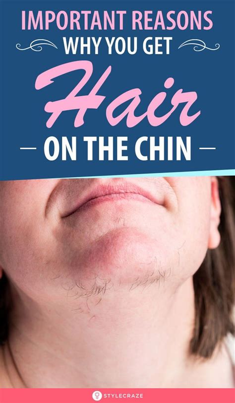 Chin Hair 6 Embarrassing Red Flags No Woman Should Ever Ignore Chin
