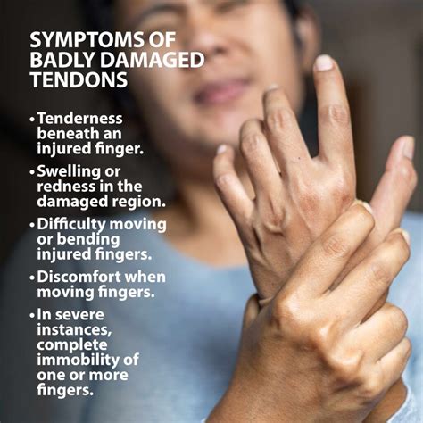 Tendon Transfers Of The Hand Florida Orthopaedic Institute