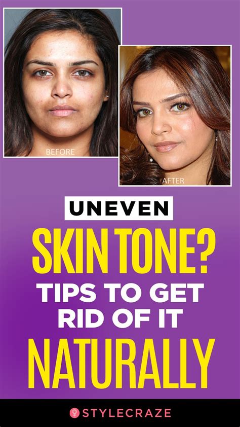 Skin Tips Skin Care Tips Beauty Skin Care Skin Care Routine Uneven