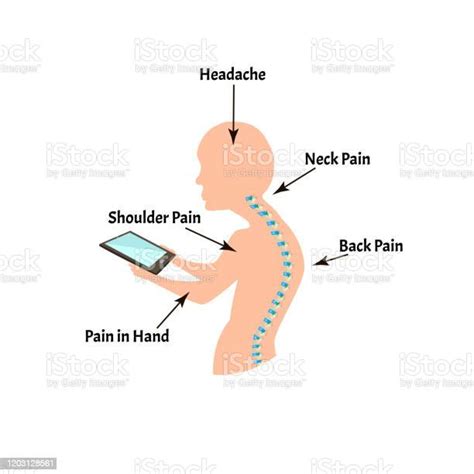 Improper Posture Symptoms Text Neck Syndrome Spinal Curvature Kyphosis