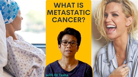 What Is Metastatic Breast Cancer Dr Tasha Explains In This Video