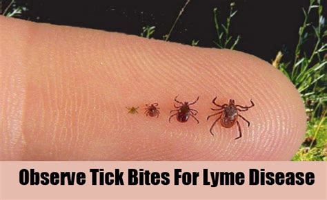 5 Symptoms And Treatment Of Lyme Disease How To Identify Lyme Disease