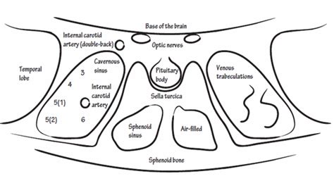 Applied Anatomy Of Cavernous Sinus Epomedicine