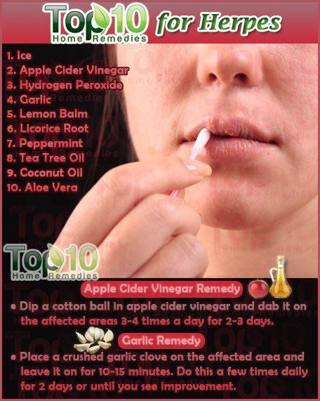 The herpes virus over 42% do not go away on their own. Home Remedies for Herpes | Top 10 Home Remedies