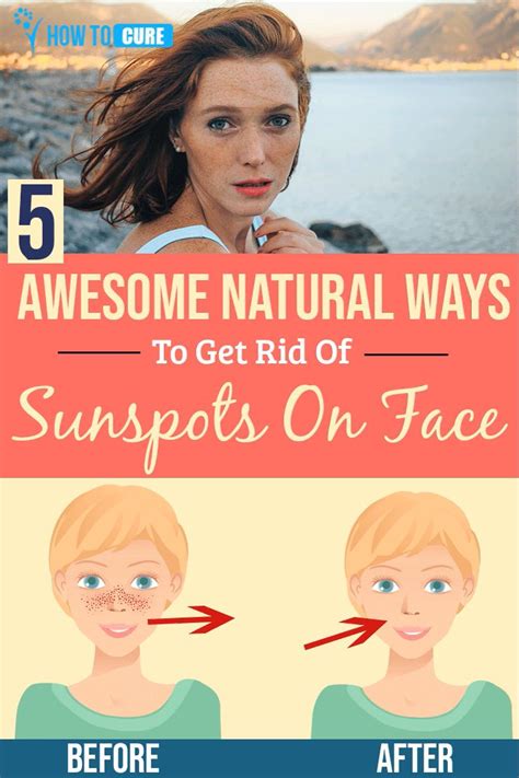 5 Wondrous Natural Ways For How To Get Rid Of Sunspots On Face Video Video In 2020