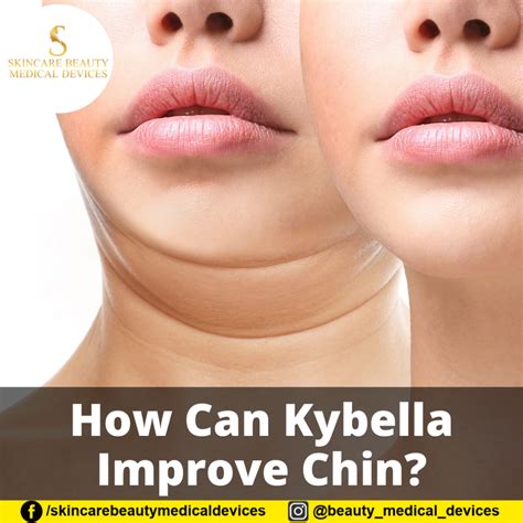 How Can Kybella Improve Chin