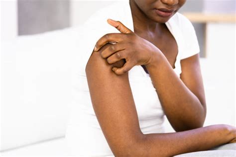 Stress Rash What Is It And How To Treat It BlackDoctor Org