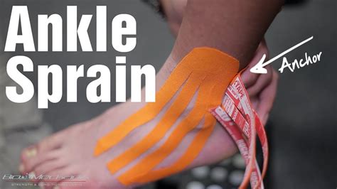How To Wrap A Sprained Ankle Drbeckmann