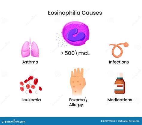 Causes Of The Eosinophilia Diagram Showing Most Popular Disorders