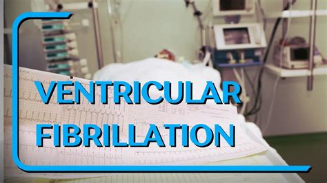 Ventricular Fibrillation Symptoms Causes And Emergency Treatment
