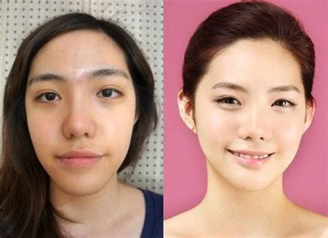 Before And After Photos Of Korean Plastic Surgery Part Pics Izismile