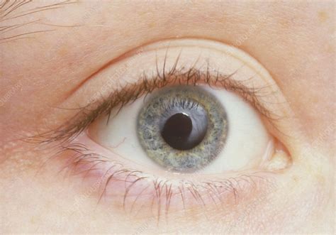 Human Eye Showing Dilated Pupil Stock Image P4200002 Science