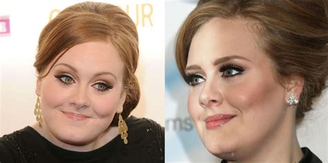 Adele Before And After Plastic Surgery 4 Celebrity Plastic Surgery