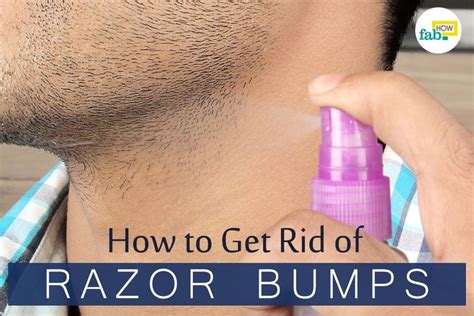 How To Get Rid Of Razor Bumps On Vag The Try These Home Remedies On