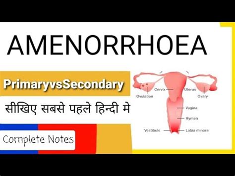 Gynaecology Obstetrics Lecture Primary Secondary Amenorrhoea