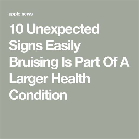 10 Unexpected Signs Easily Bruising Is Part Of A Larger Health