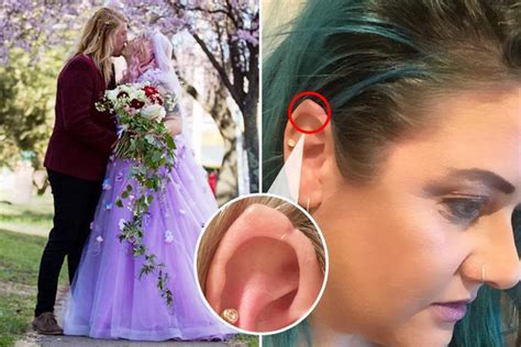 Bride Spent £1000 On Silicone Implants To Give Her Pointed Elf Ears