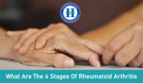 Symptoms And Causes Of Rheumatoid Arthritis ‣ Arthritis Homeocare
