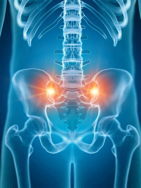 Sacroiliac Joint Paindysfunction Scottsdale Az Orthopedic Spine Surgery