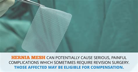 Hernia Mesh Lawsuit Consumer Safety Watch Consumer Safety Watch