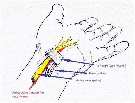 Carpal Tunnel Syndrome The Hand Clinic