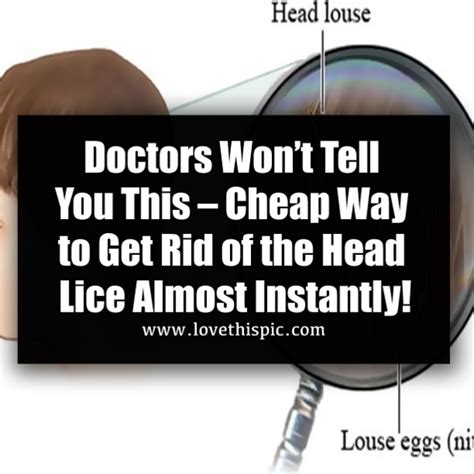 Doctors Wont Tell You This Cheap Way To Get Rid Of The Head Lice