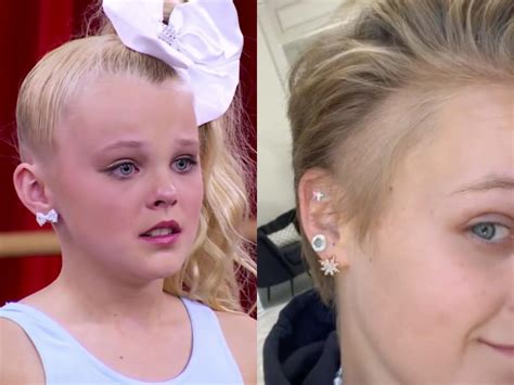 Jojo Siwa Reveals A Bald Spot On The Side Of Her Head Was Caused By A Stress Rash When She Was
