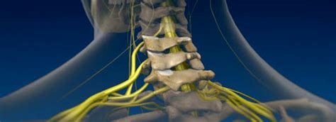 Cervical Radiculopathy Treatment At Our Orlando Pain Clinic