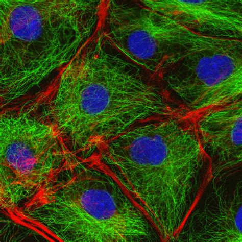 Maybe you would like to learn more about one of these? Cytoskeleton - the movers and shapers in the cell ...