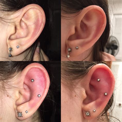 week old helix piercings have started throbbing and become swollen in the past two days in