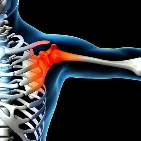 Musculoskeletal Sports Injury O360 Content Library