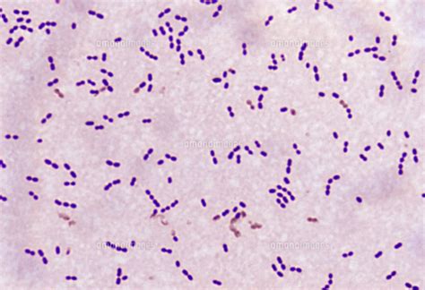 Streptococcus Pneumoniae Cocci In Pairs Gram Streptococcus