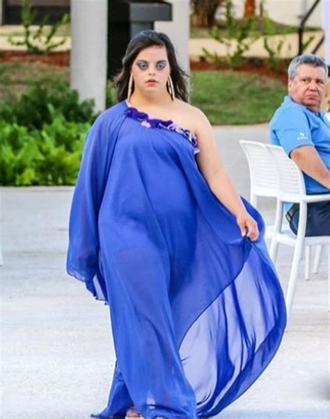 Downs Syndrome Model Takes Ny Fashion Industry By Storm