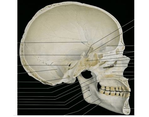 Lateral Sagittal View Of Skull — Printable Worksheet