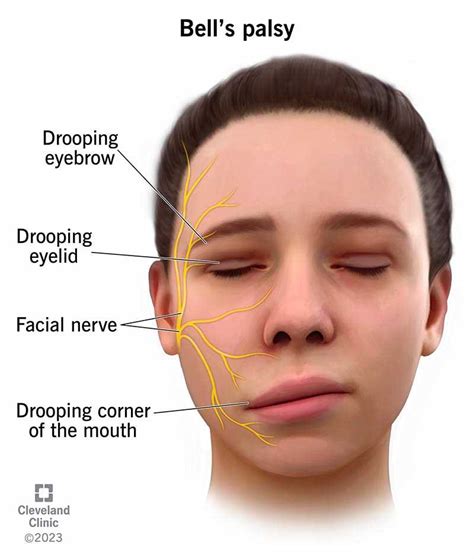 Causes And Treatment For One Side Of Face Swollen Exploring The