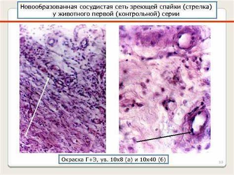 Спаечная болезнь брюшной полости диета Послеоперационный спаечный процесс брюшной полости и спаечная болезнь Послеоперационный спаечный процесс брюшной полости и спаечная болезнь Спаечная болезнь брюшной полости диета