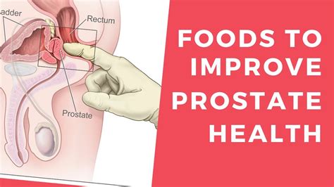 Foods To Improve Prostate Health Superfoods For A Healthy Prostate 8 Foods That Protect