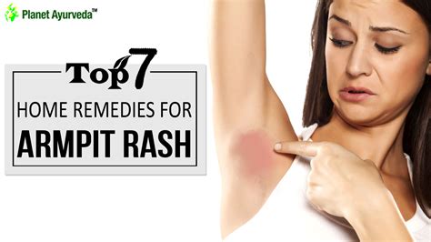 Itchy Armpit Rash Treatment