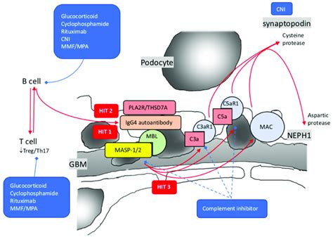 Pathogenesis Of Idiopathic Membranous Nephropathy With 3 Hits Theory